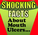 The Truth About Mouth Ulcers