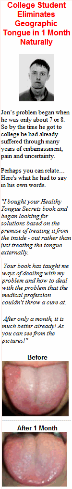 College Student Eliminates Geographic Tongue in 1 Month Naturally