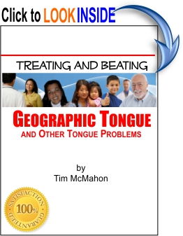 Treating and Beating Geographic Tongue and Other Tongue Problems