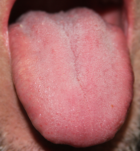 Pretty Good Tongue