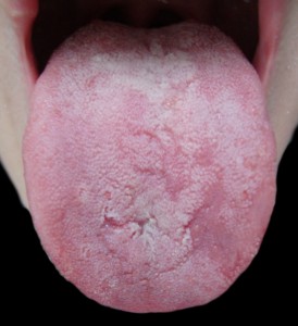 Beefy tongue